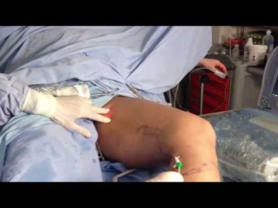 Real operation