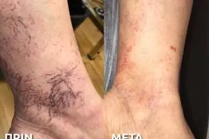 42
