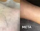 45